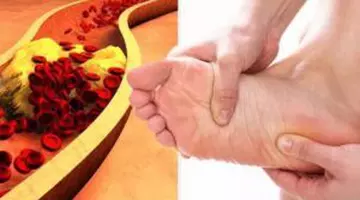 Semnul ascuns al colesterolului ridicat care poate apărea pe gleznă