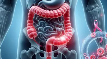 Un supliment ieftin, ignorat ani la rând, ar putea reduce riscul de cancer de colon