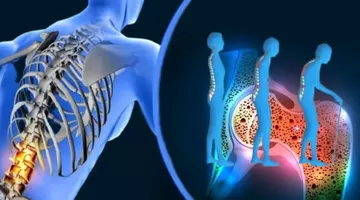 „Dieta care îți poate salva oasele”: 15 alimente recomandate de experți pentru a preveni osteoporoza și pierderea osoasă