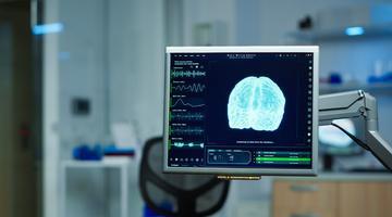 Ciuperca mortală care atacă creierul și ucide până la 70% dintre pacienți. Cazurile au crescut de patru ori