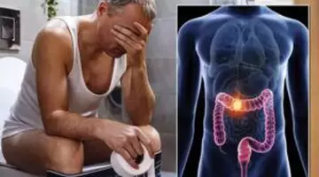 Băutura iubită de români, care crește riscul de apariție a cancerului de colon cu 25%