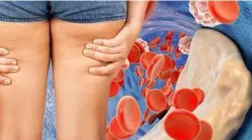 Aceasta este leguma numărul 1 pentru prevenirea plăcii arteriale