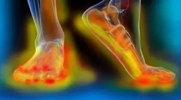 Amorțeală la picioare? Semnul „tăcut” al diabetului care poate duce la complicații grave dacă îl ignori