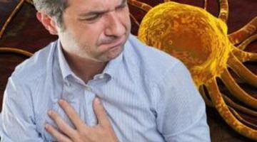 10 semne care pot anunța cancerul. Simptomul ignorat de mulți români apare și noaptea