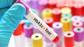 Cum poți să afli ultra-rapid dacă ai prediabet? Descoperire revoluționară!