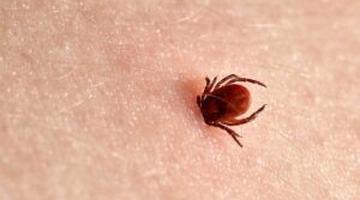 Ce se poate întâmpla după o mușcătură de căpușă. Sindromul care îi pune în alertă pe specialiști