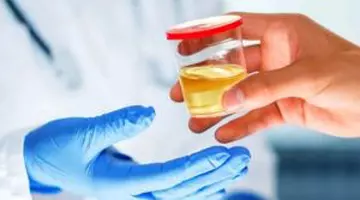 Ce spune culoarea urinei despre sănătatea ta. Semnele pe care nu trebuie să le ignori