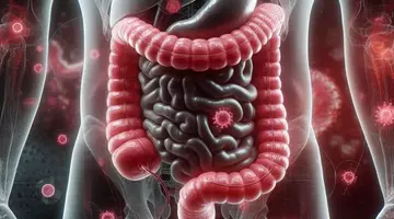 Un bărbat de 31 de ani a fost diagnosticat cu cancer de colon după ce a ignorat aceste semne