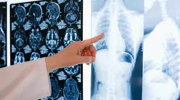 Atenționare pentru cei care au trecut de 60 de ani. Un medic avertizează: Atunci sunt diagnosticate frecvent multe boli grave