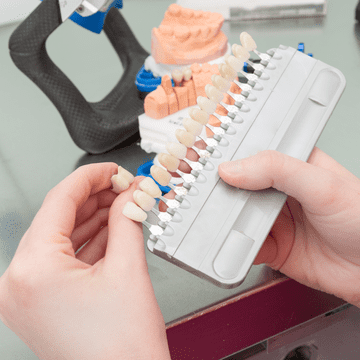 Avantajele pe care le ai dacă apelezi la faţete şi implant dentar