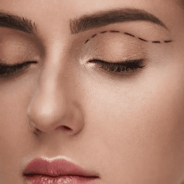 Blefaroplastia: o soluție subtilă pentru un chip întinerit