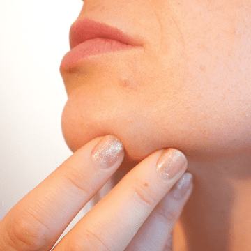 Cum să ai grijă de tenul gras cu tendință acneică. Sfaturi direct de la dermatolog/ Exclusiv