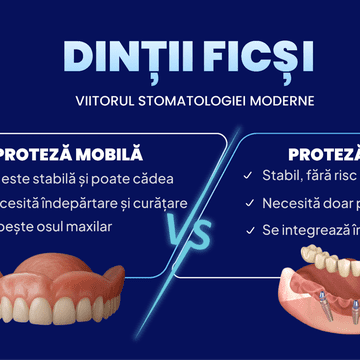 Dinții ficși – viitorul stomatologiei moderne