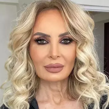 Daniela Gyorfi, nouă intervenție estetică la 57 de ani. Cum arată acum cântăreața: „Mă bucur că am avut curajul”