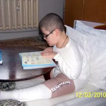 Copilul cu oase de sticlă caută oameni cu suflet de aur