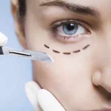 Totul despre istoria operaţiilor estetice