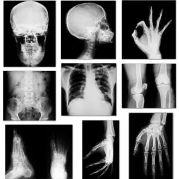 16 lucruri pe care nu le ştiai despre oasele tale