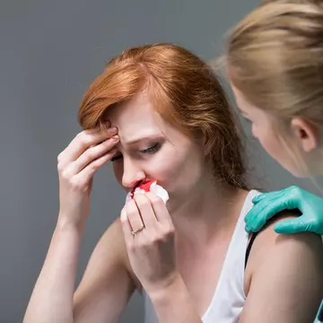 De ce îţi curge sânge din nas şi cum îl opreşti