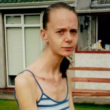 Foto: cum arăta adolescenta de 31 de kilograme