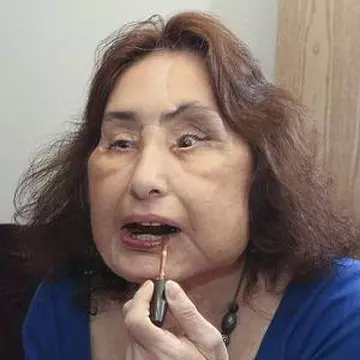 Foto: femeia care şi-a făcut transplant de faţă
