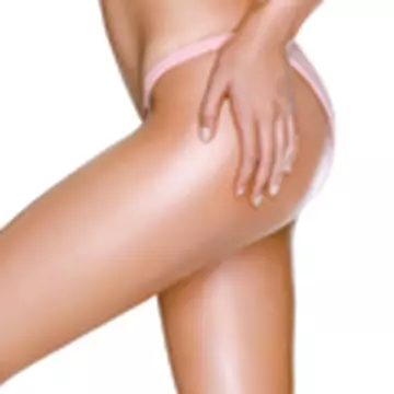 Celulita