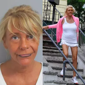 Poze: vezi la ce duce excesul de solar!