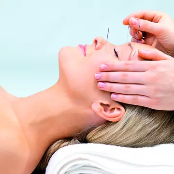 Acupunctura cosmetica mi-a intinerit fata cu 7-8 ani