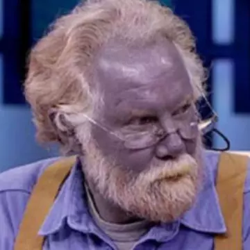 Şocant: Cele mai ciudate boli din lume