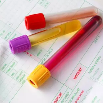 Campania "HPV – CUNOAŞTE  RISCUL!”. Cum obţii reduceri la analize