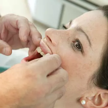 Stomatologie: Cum îţi îngrijeşti corect gingiile?