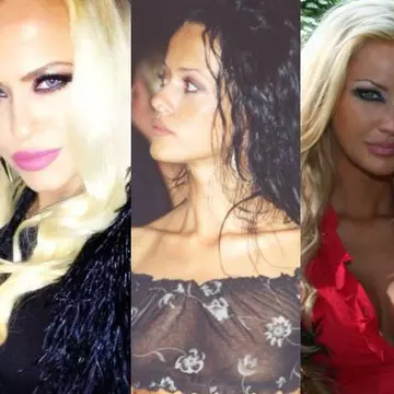 România: 5 vedete înainte şi după operaţiile estetice. Uite cum s-au schimbat!