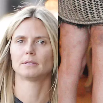 POZE: Imagini şocante pe care vedetele nu ar vrea să le vezi!