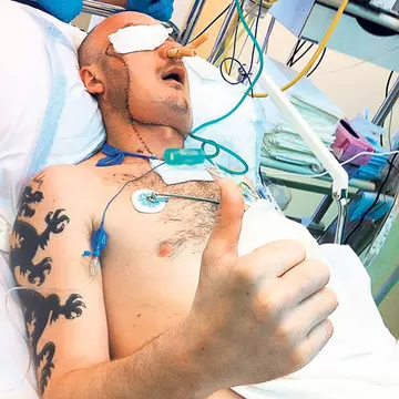 Premieră medicală mondială în Polonia! I-au schimbat faţa în 27 de ore