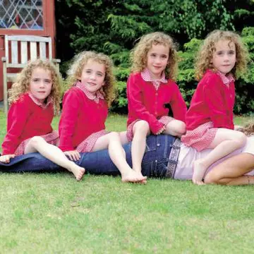 Inedit: 4 gemeni identici, un caz la 64 de milioane