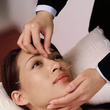 Cele mai noi metode de acupunctură