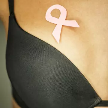 Cancerul de sân - ce este HER2