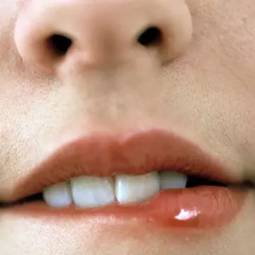3 tratamente naturiste pentru herpes