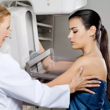 Cancerul la sân – metode de prevenţie
