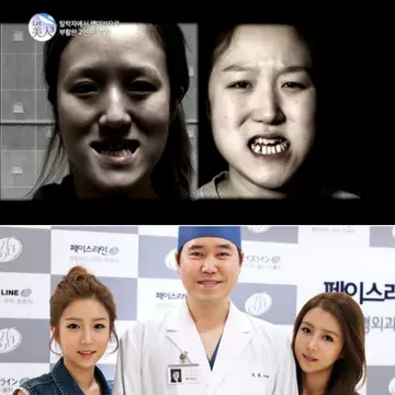 2 coreence urâte, transformate în miss de chirurgia estetică