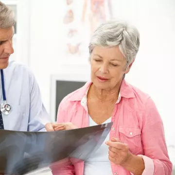 Cum ameliorezi simptomele simţite la menopauză. Vezi ce tratamente există