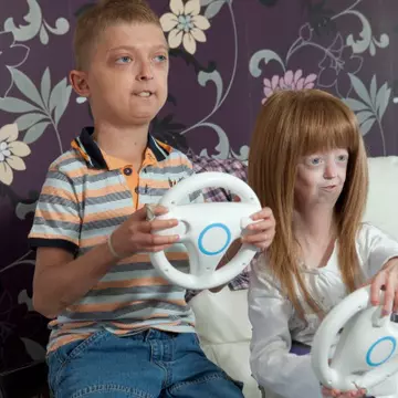 Progeria: Vezi GALERIA FOTO cu boala necruţătoare