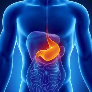 Top 4 factori de risc pentru apariția cancerului gastric