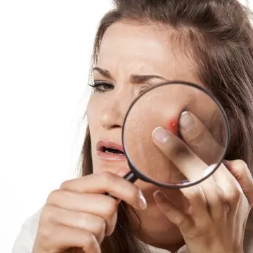 Doctor Oz: Cum să spargi corect un coş