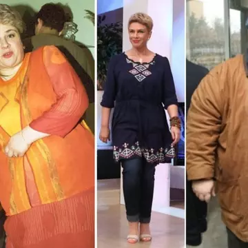 Au apelat la bisturiu pentru a slăbi. Top 5 vedete care şi-au micşorat stomacul