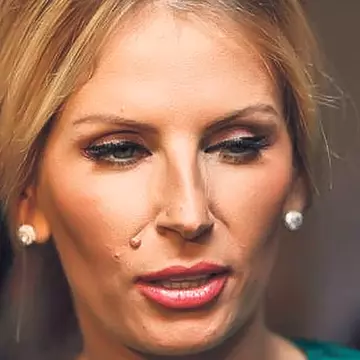 Andreea Bănică şi-a reparat faţa la 36 de ani!