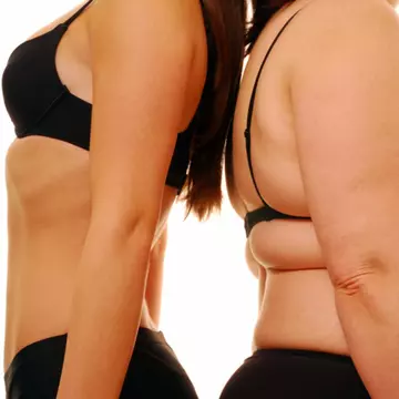 Cancerul la sân, influenţat direct de excesul de kilograme