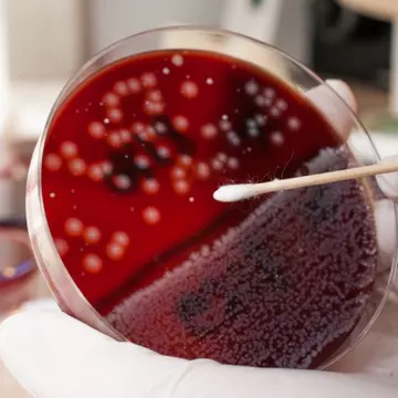 4 mituri despre HPV demontate