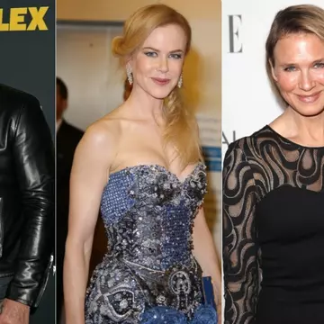 De nerecunoscut! Vedete deformate de botox