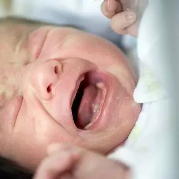 Atenţie, părinţi!  "Sărutul îngerilor", superstiţia care ascunde o boală periculoasă pentru bebeluşi!