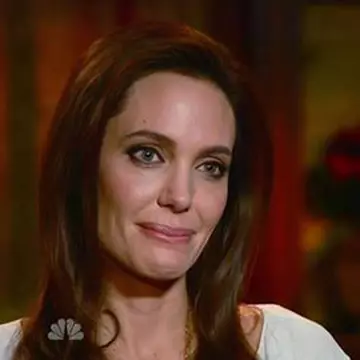 Angelina Jolie, plină de bube